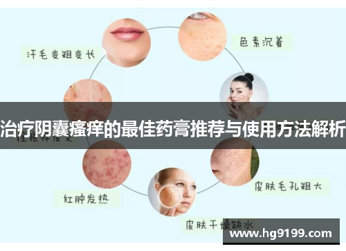 治疗阴囊瘙痒的最佳药膏推荐与使用方法解析